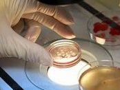 2026杭州男性结扎医院排名榜，内附费用以及报销标准！