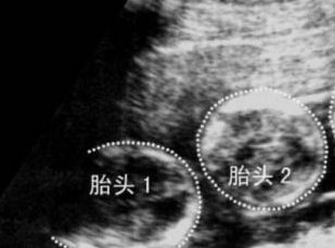 2026福州哪家医院有库？哪些医院拥有能够为患者进行试管婴儿的生殖技术？